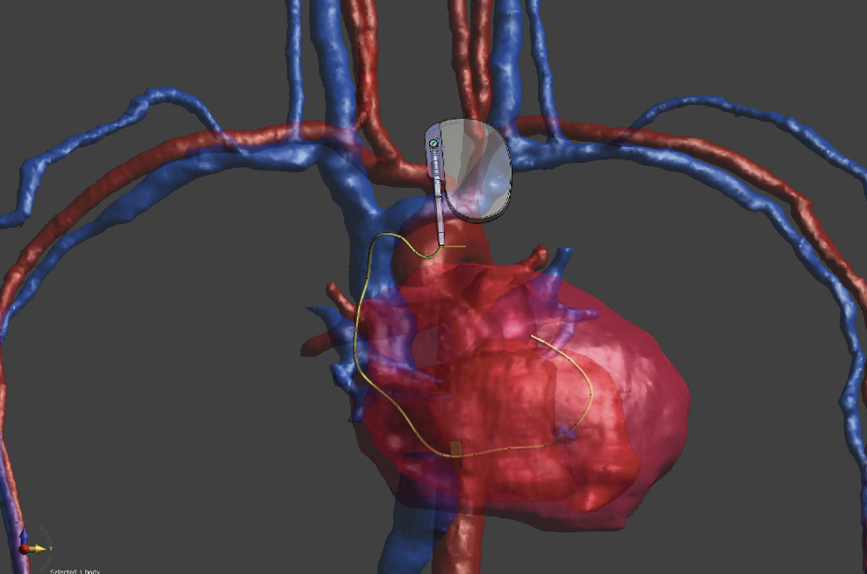 Health monitoring device
